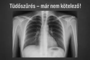 tudoszures munkavedelem elelmiszer